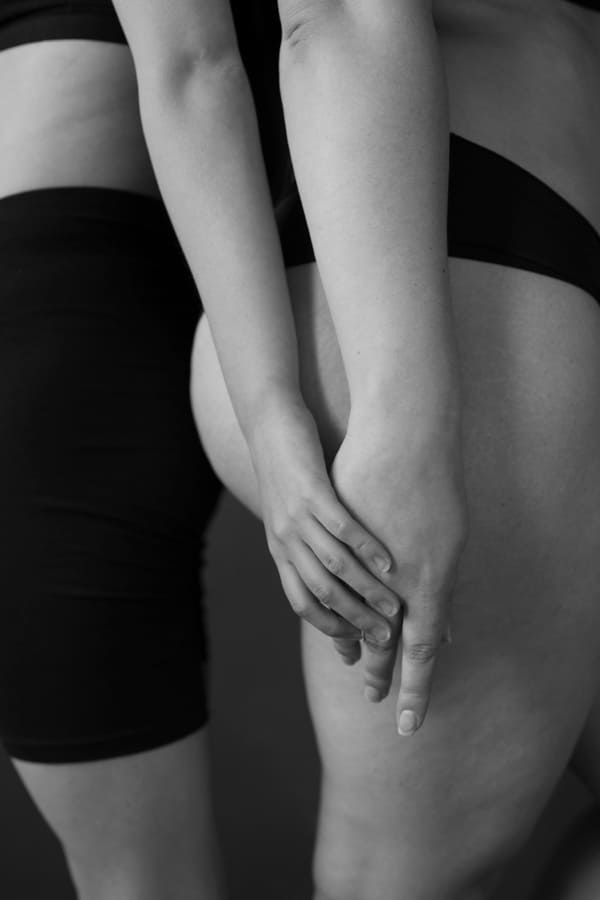 Anticellulite Procedure